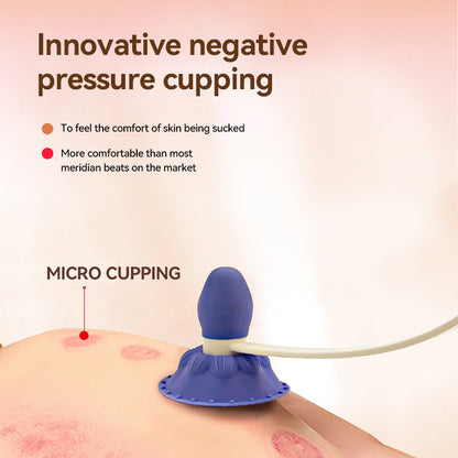 Negative Pressure Meridian Tap